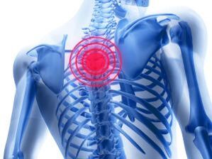 osteochondrosis of the chest area