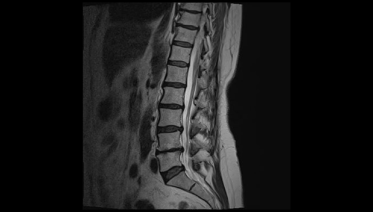 diagnosis of back pain in the lumbar region