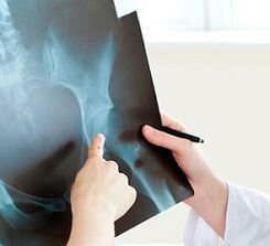 how to treat osteoarthritis of the hip